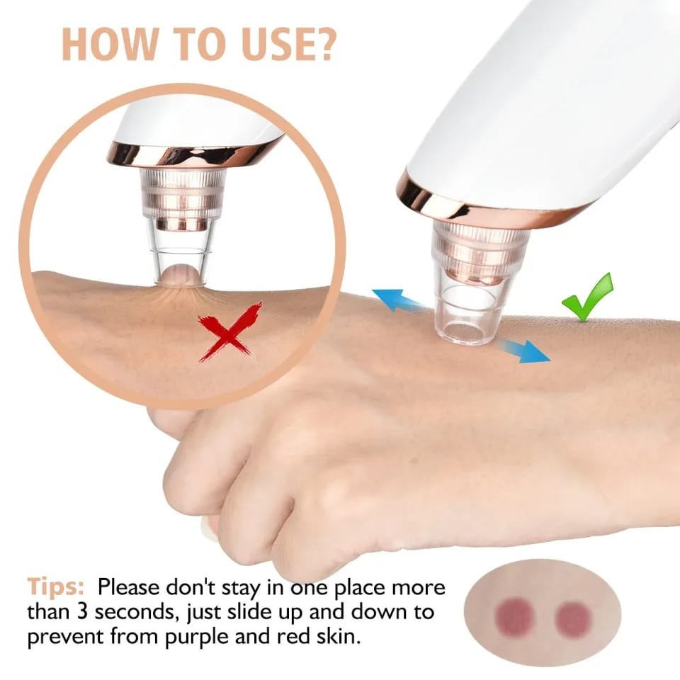Multifunctional Cleaning Instrument For Pore Acne Pimple Removal and Vacuum Suction Facial Pore Cleaner